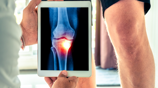 A 3 legrosszabb szokás, ami miatt még jobban fáj a térded (és észre sem veszed)